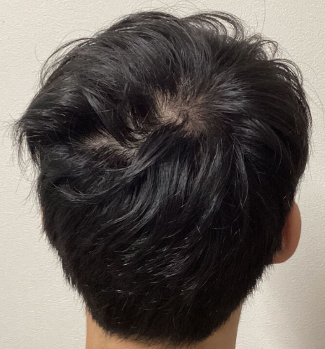 施術後