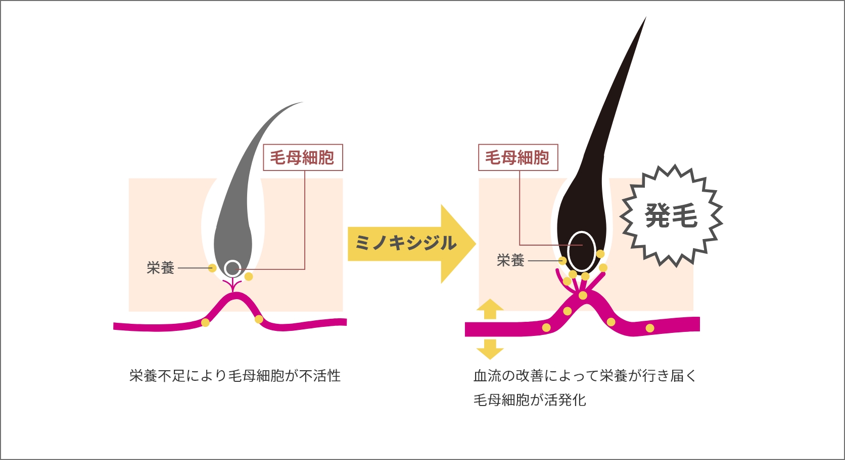 ミノキシジルの作用