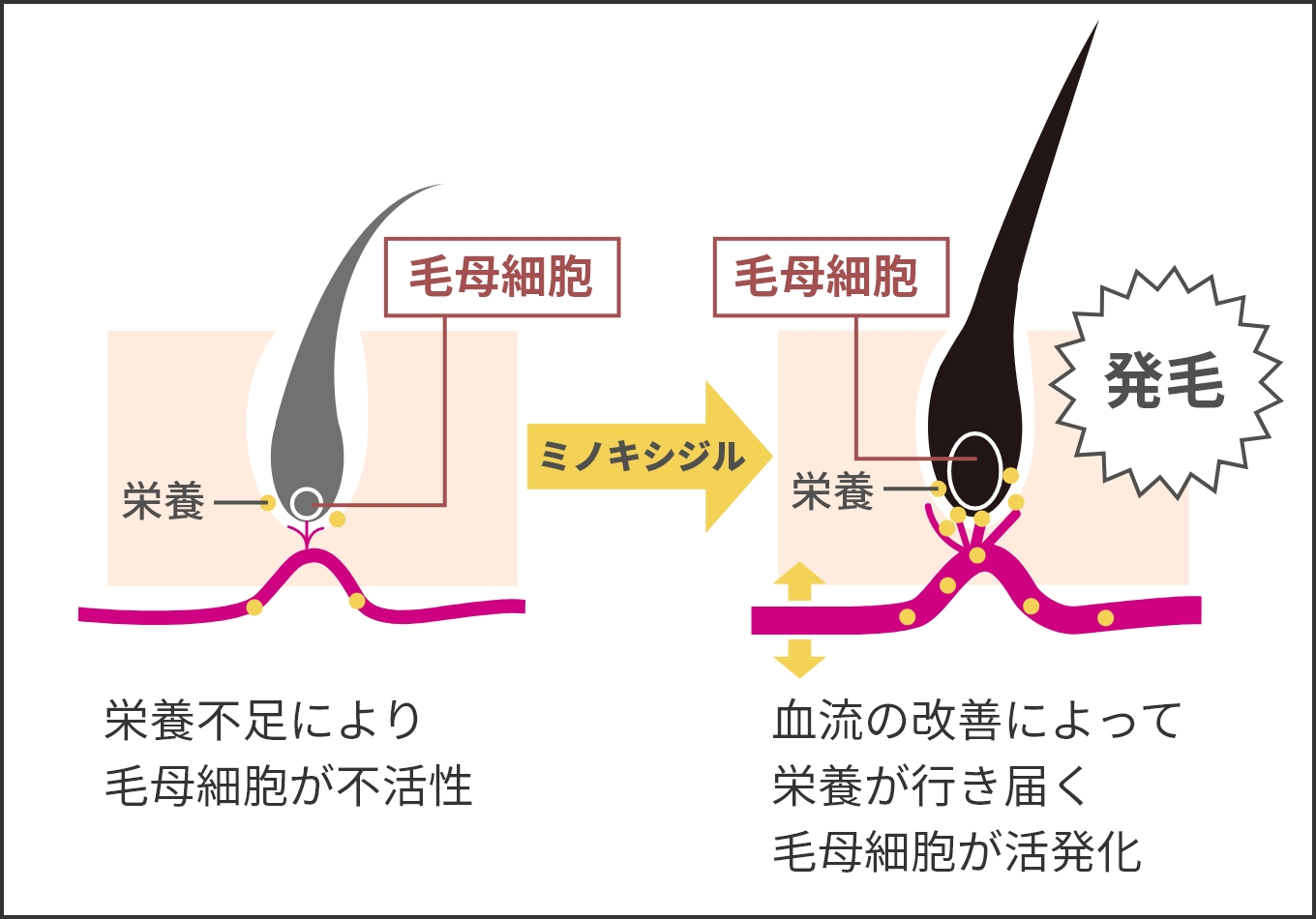 ミノキシジルの作用
