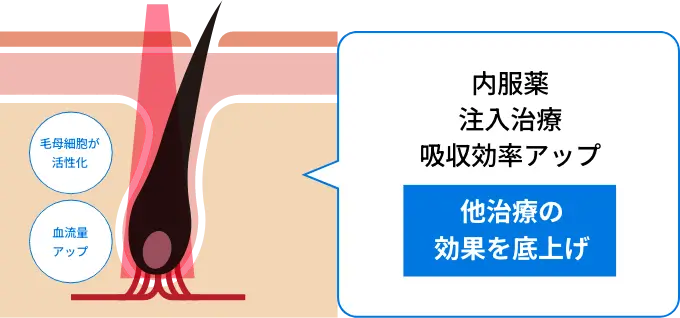 内服薬・注入治療吸収効率アップ、他治療の効果を底上げ