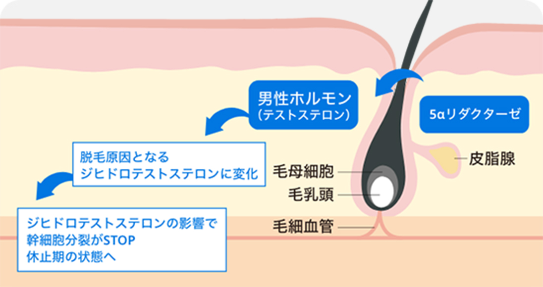ジヒドロテストステロンのメカニズム