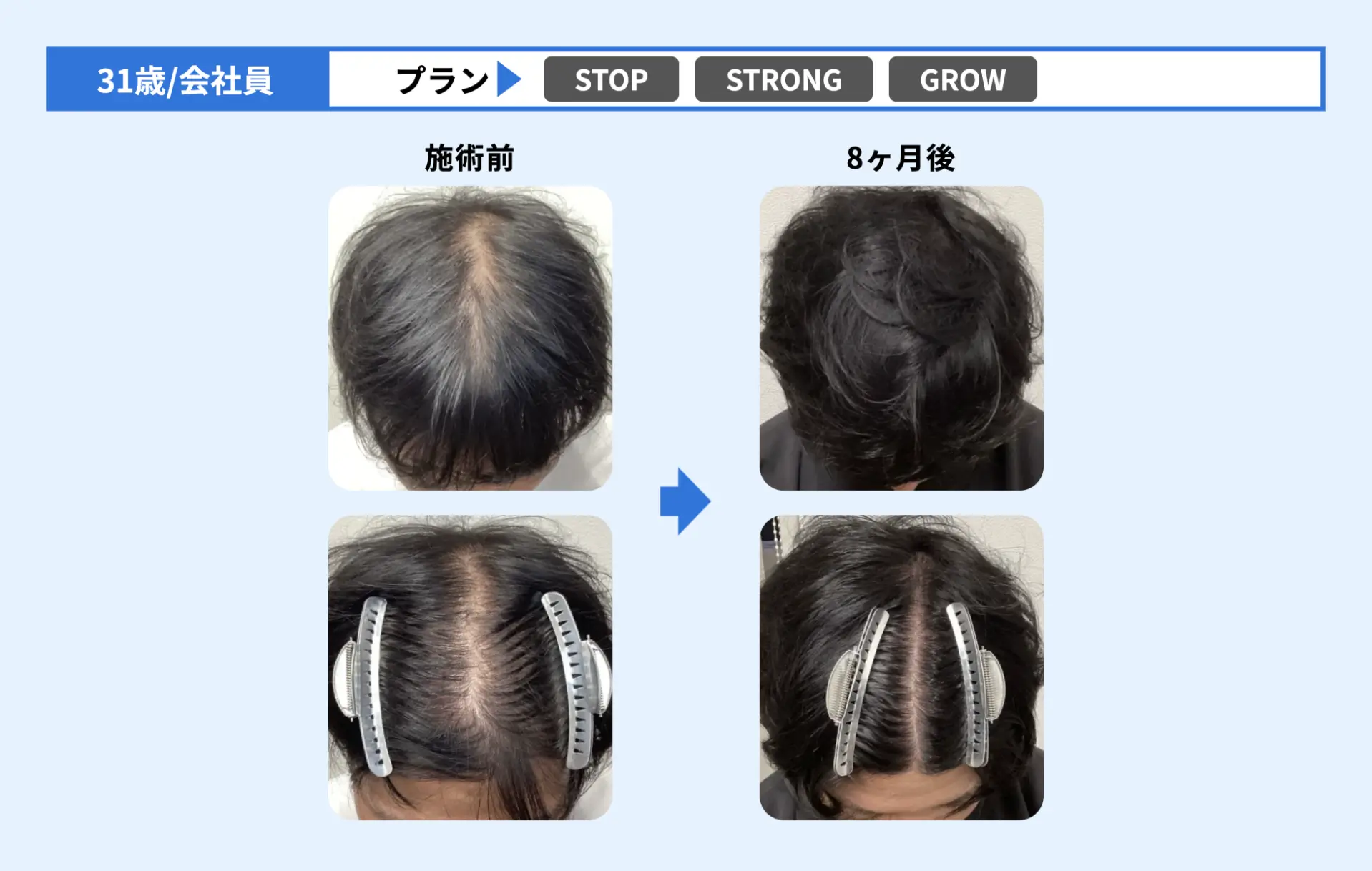 掲載例