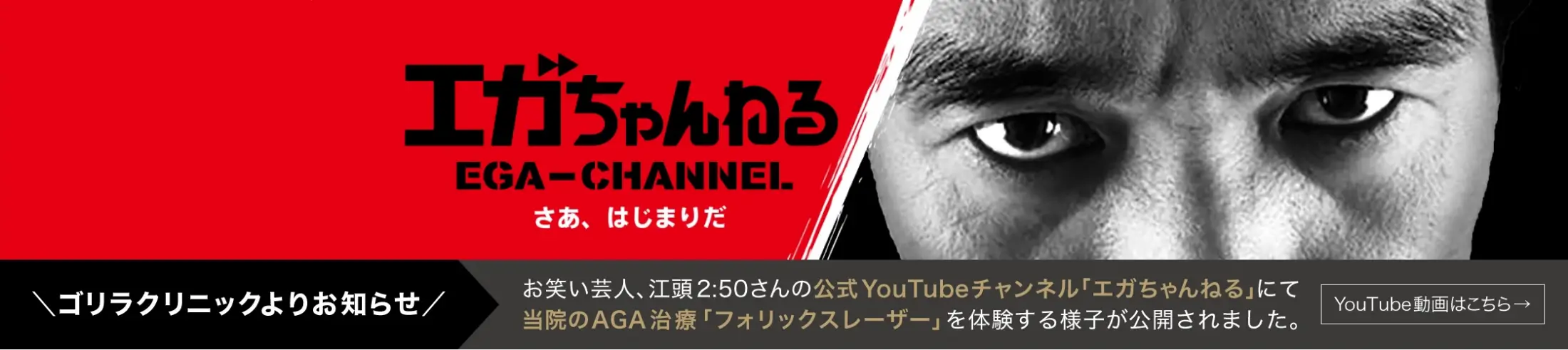 エガちゃんねる お笑い芸人、江頭2:50さんの公式YouTubeチャンネル「エガちゃんねる」にて当院のAGA治療「フォリックスレーザー」を体験する様子が公開されました。 YouTube動画はこちら