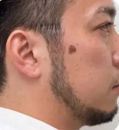 Before