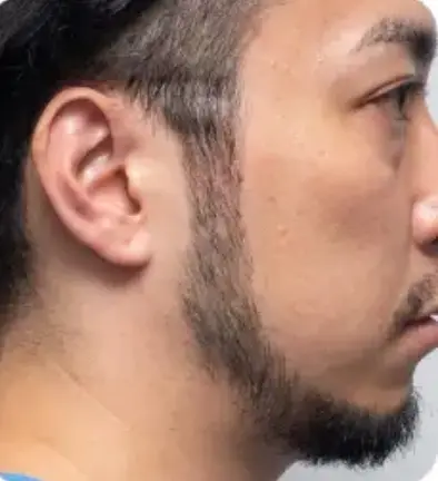 After
