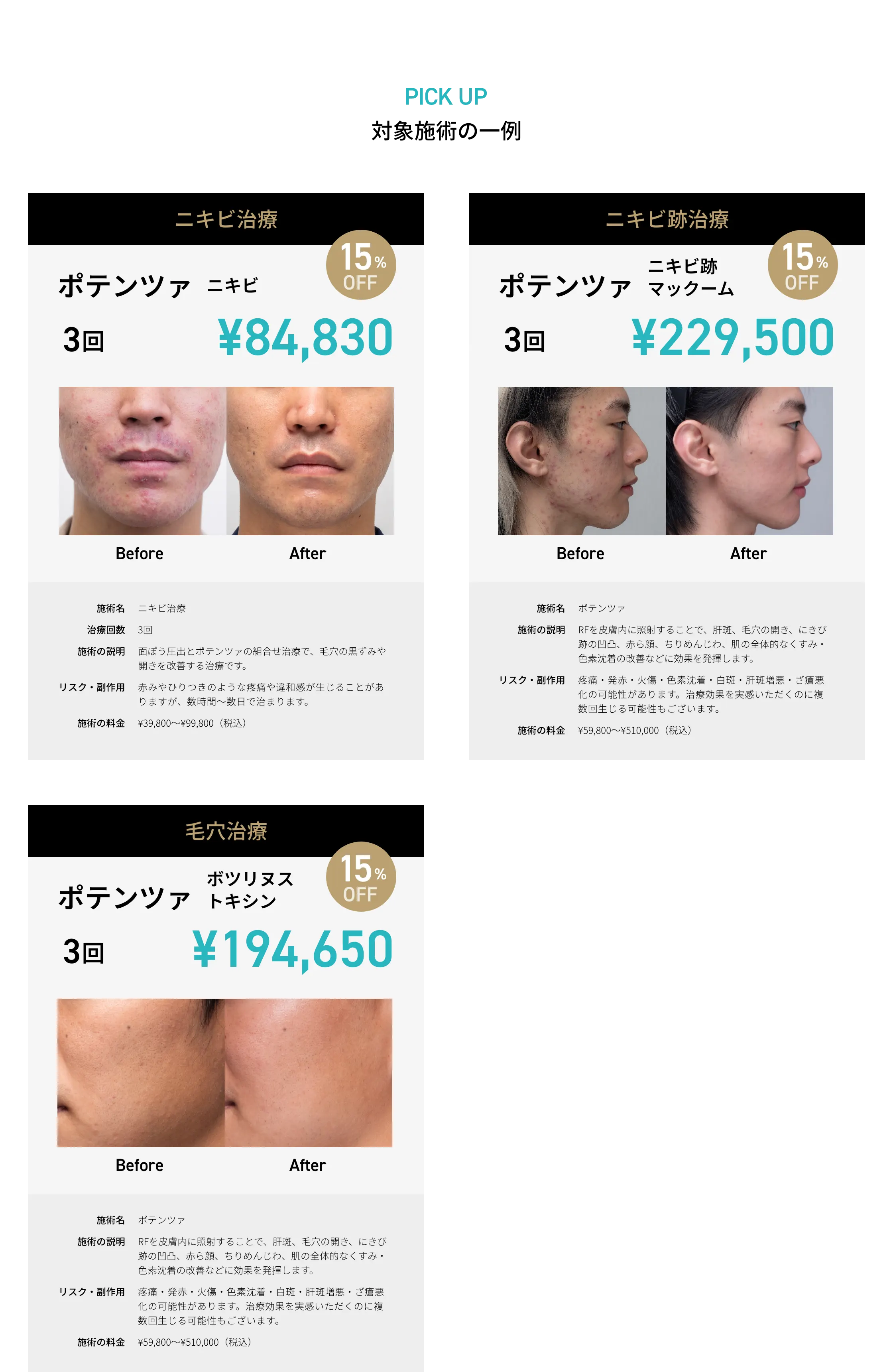 CP画像