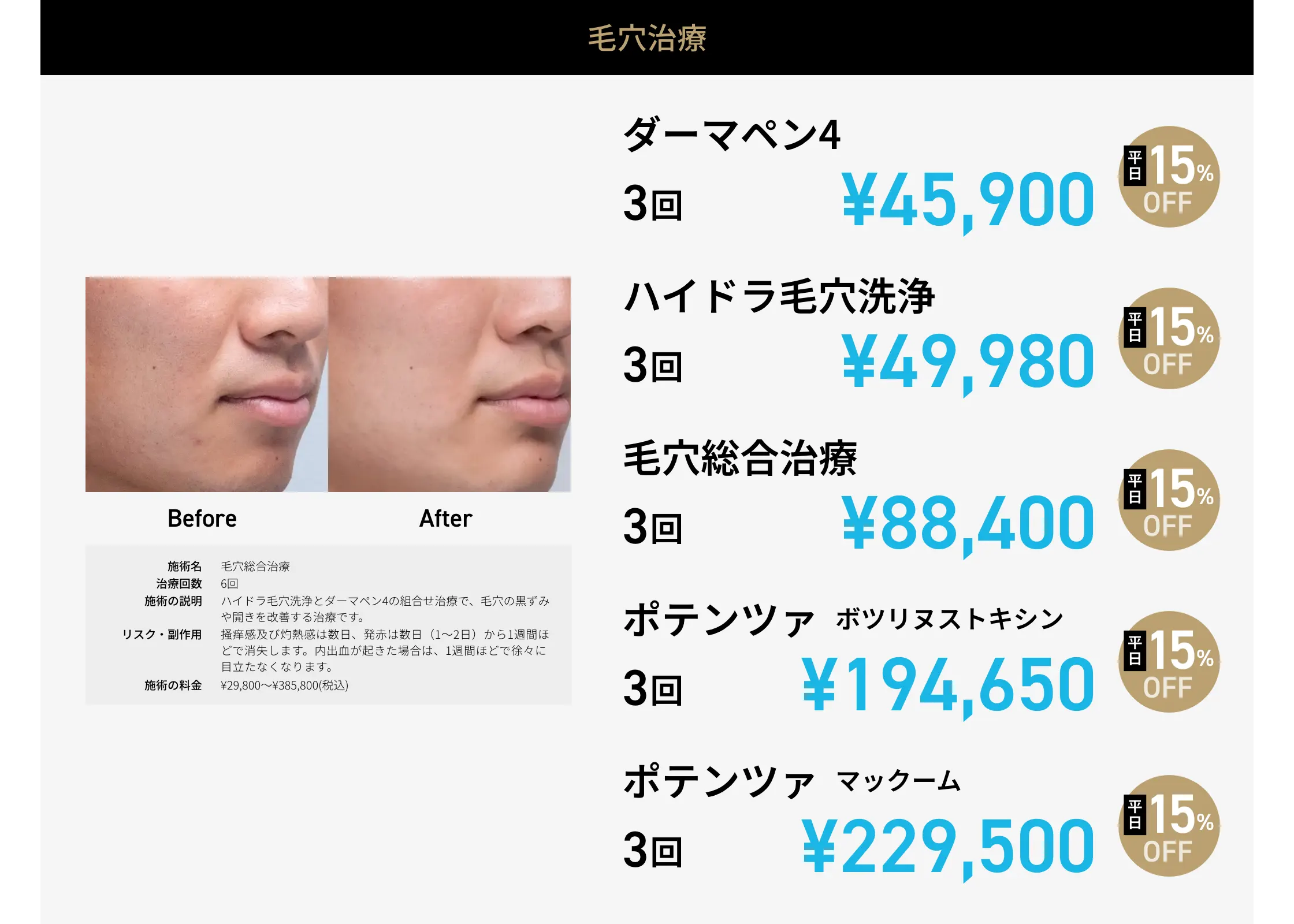 CP画像