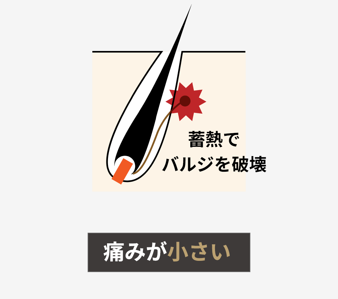 蓄熱でバルジを破壊　痛みが小さい