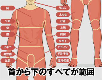 首から下のすべてが範囲
