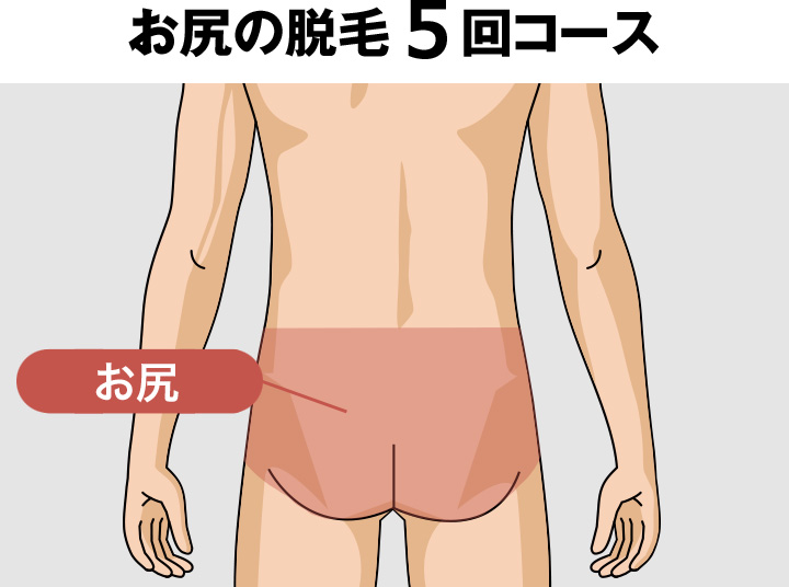 お尻(ケツ毛)の脱毛料金