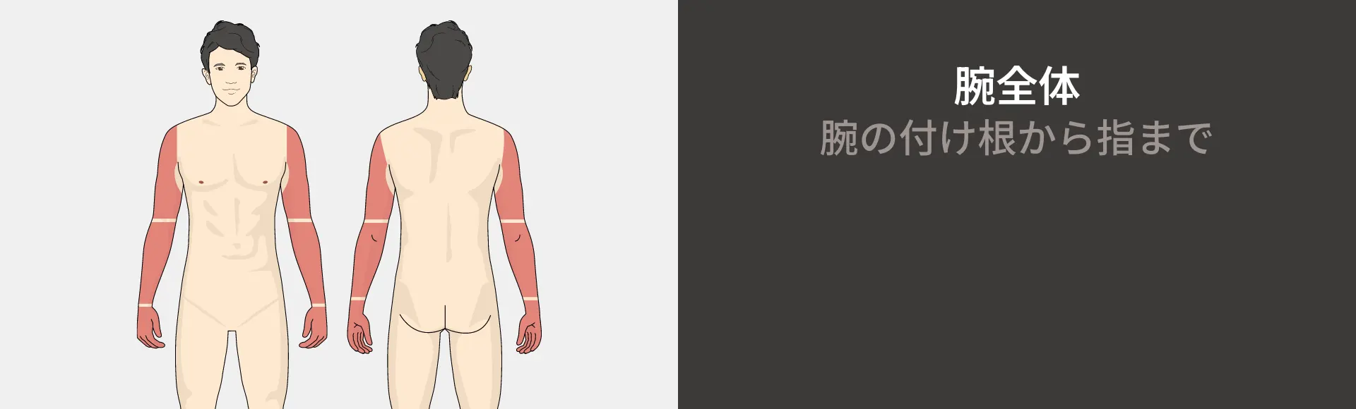 腕全体コースの医療レーザー脱毛 腕の付け根から指まで ¥158,800円