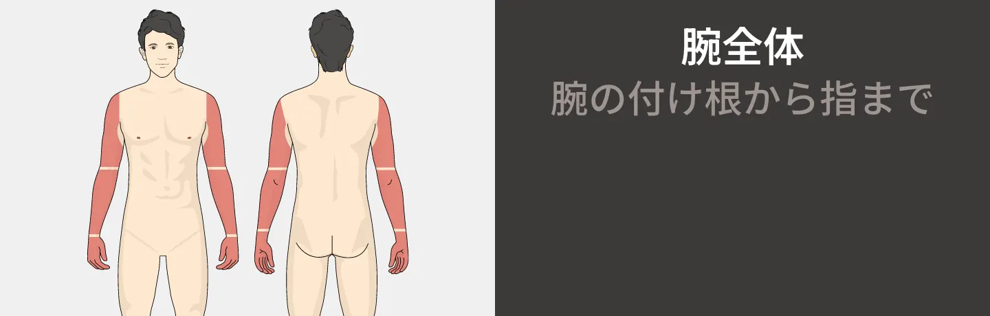 腕全体コースの医療レーザー脱毛 腕の付け根から指まで ¥158,800円