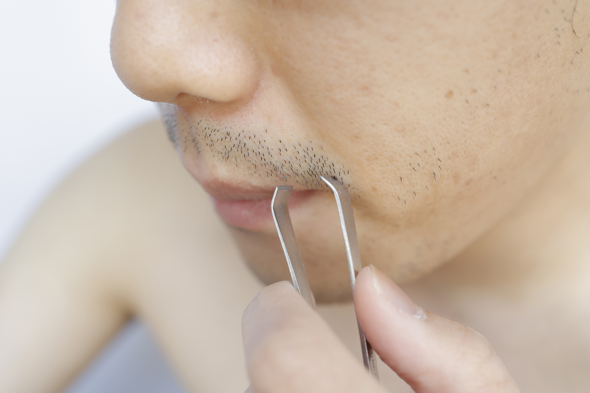 Stubble,Around,The,Mouth.,A,Man,With,A,Hair,Puller.