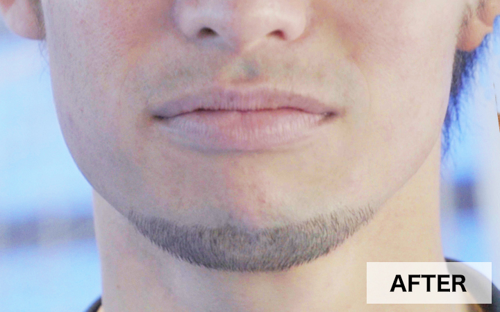 AFTER