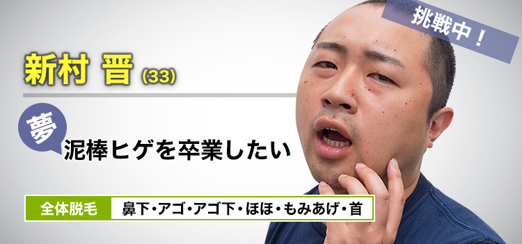 お笑い芸人 新村 晋(33) 挑戦中! 夢・泥棒ヒゲを卒業したい 全体脱毛 鼻下・アゴ・アゴ下・ほほ・もみあげ・首