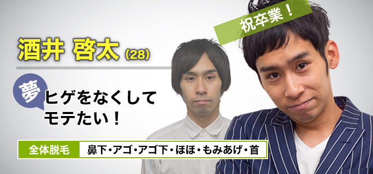 お笑い芸人 酒井 啓太(28) 祝卒業! 夢・ヒゲをなくしてモテたい! 全体脱毛 鼻下・アゴ・アゴ下・ほほ・もみあげ・首