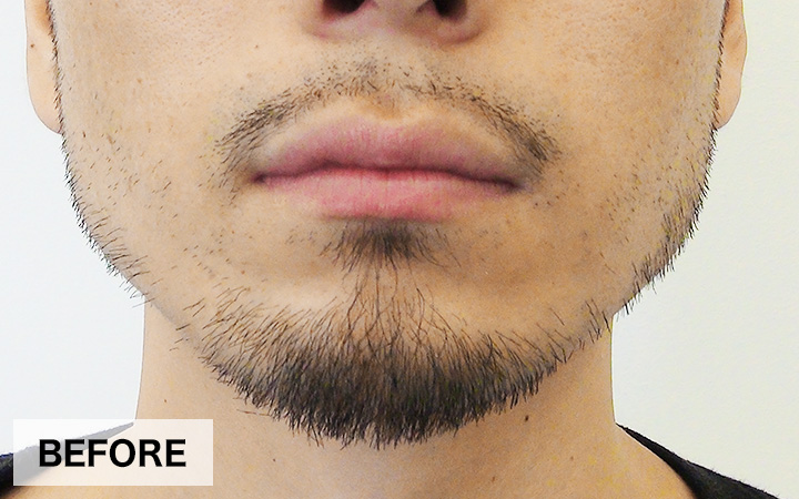 BEFORE