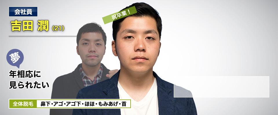 会社員 吉田 潤(21) 祝卒業! 夢・年相応に見られたい 全体脱毛 鼻下・アゴ・アゴ下・ほほ・もみあげ・首