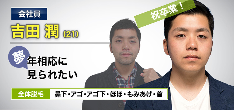 会社員 吉田 潤(21) 祝卒業! 夢・年相応に見られたい 全体脱毛 鼻下・アゴ・アゴ下・ほほ・もみあげ・首