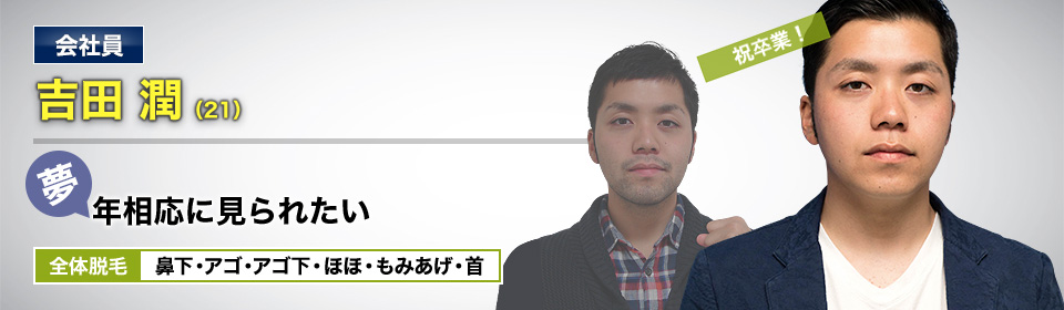 会社員 吉田 潤(21) 祝卒業! 夢・年相応に見られたい 全体脱毛 鼻下・アゴ・アゴ下・ほほ・もみあげ・首