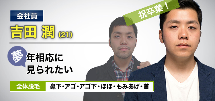 会社員 吉田 潤(21) 祝卒業! 夢・年相応に見られたい 全体脱毛 鼻下・アゴ・アゴ下・ほほ・もみあげ・首