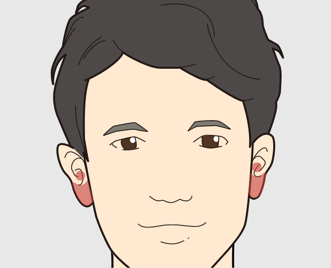 耳毛
