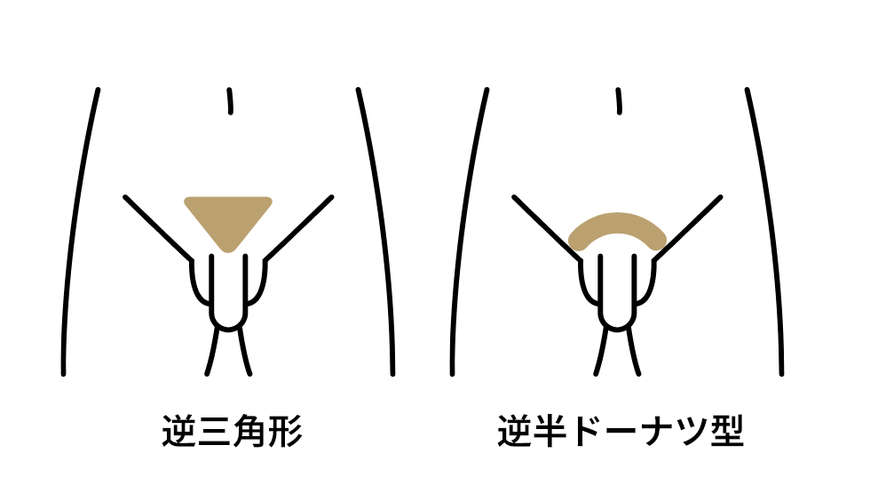 残す部位と残さない部位を自由に選択