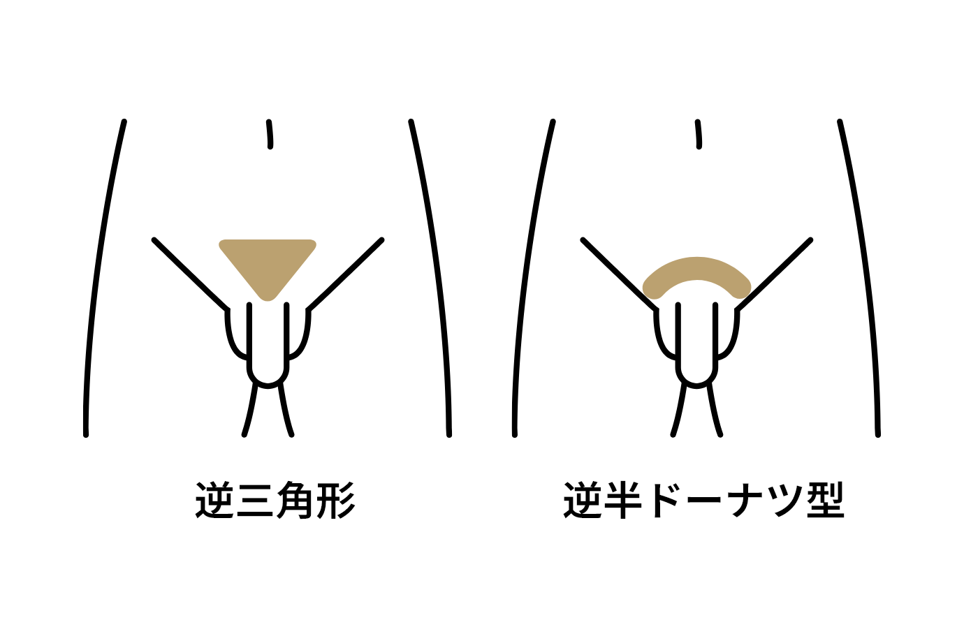 残す部位と残さない部位を自由に選択