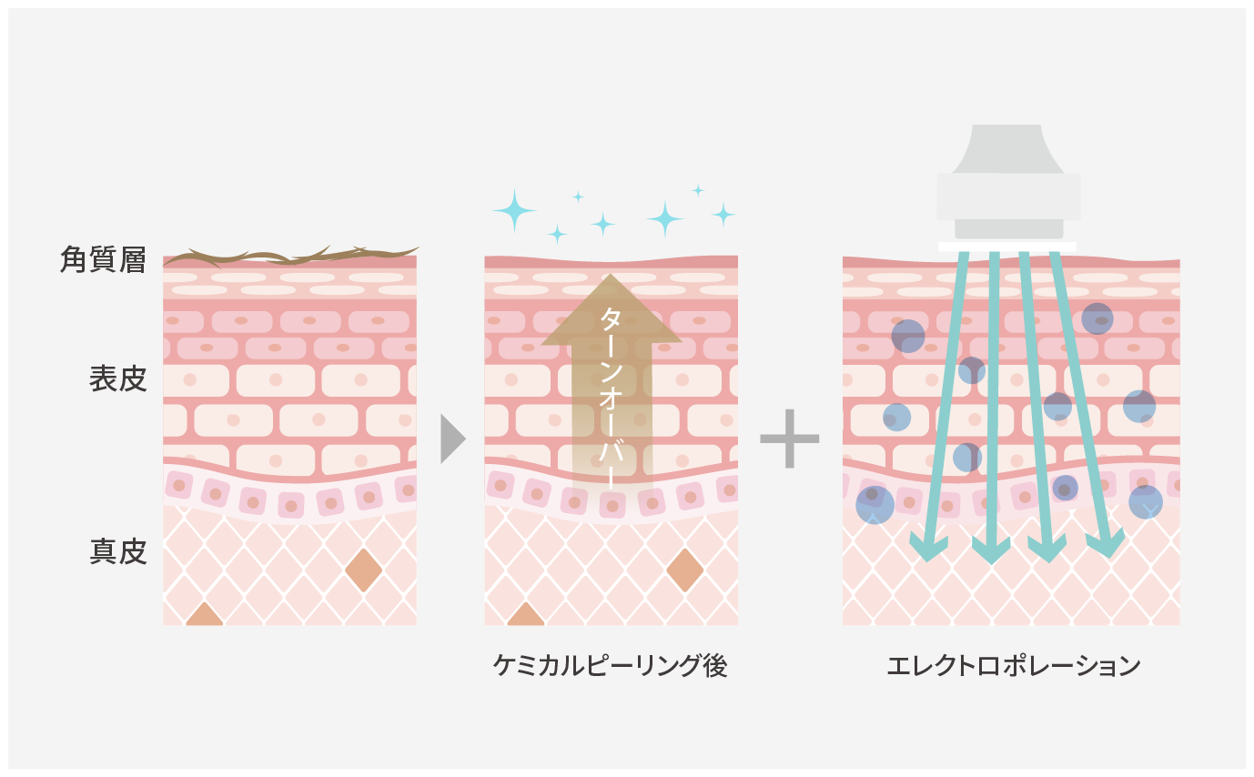 肌トリートメント