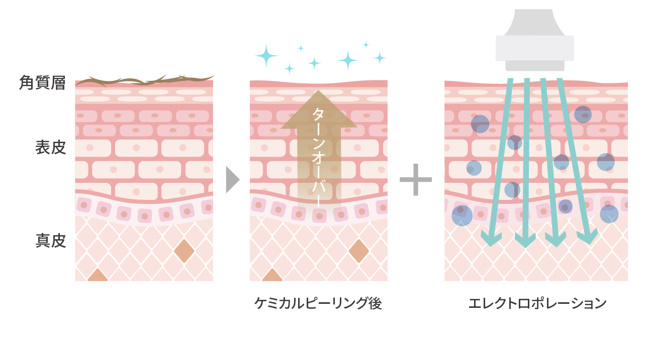 肌トリートメントの効果・仕組み