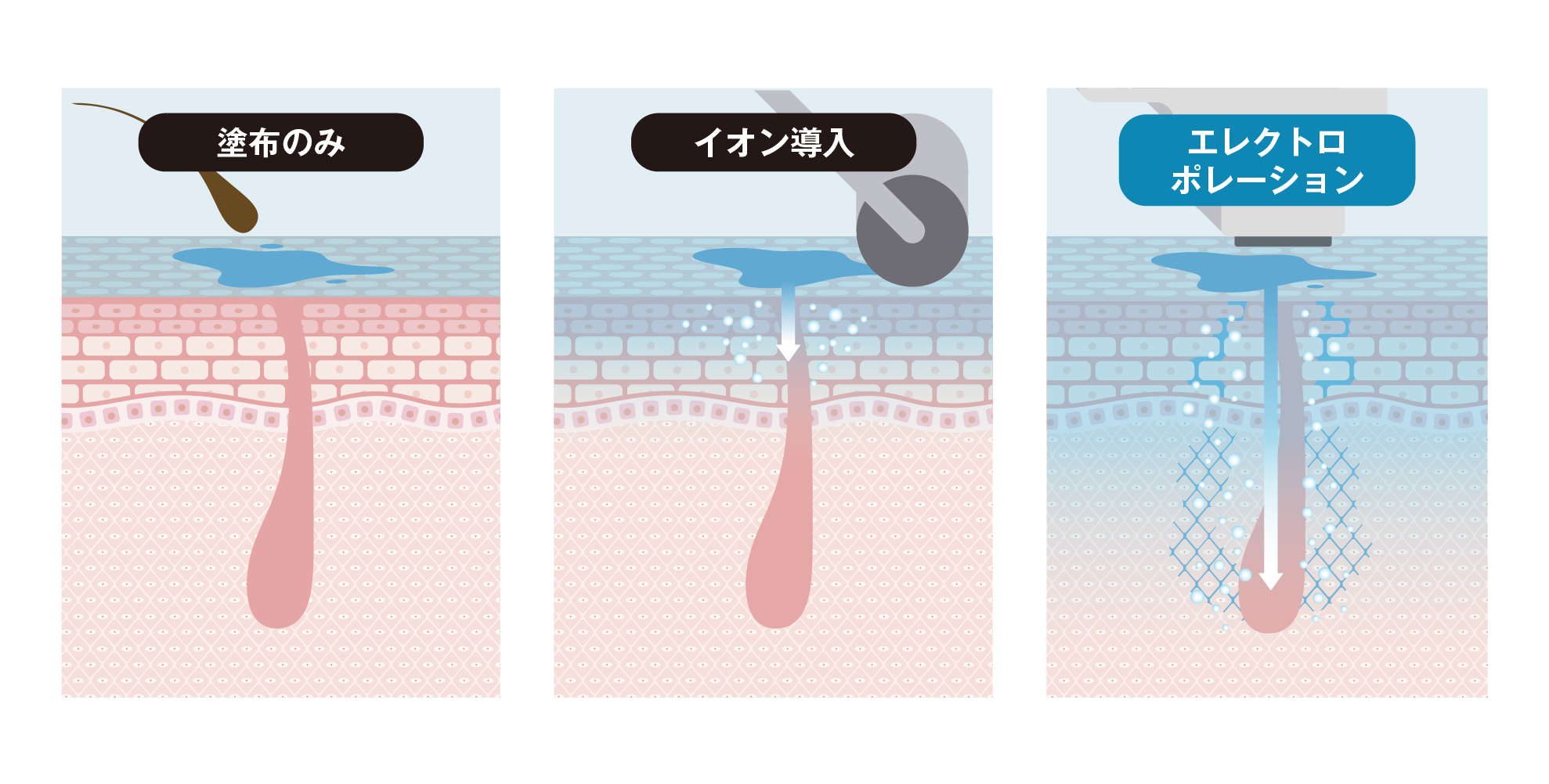 エレクトロポレーション