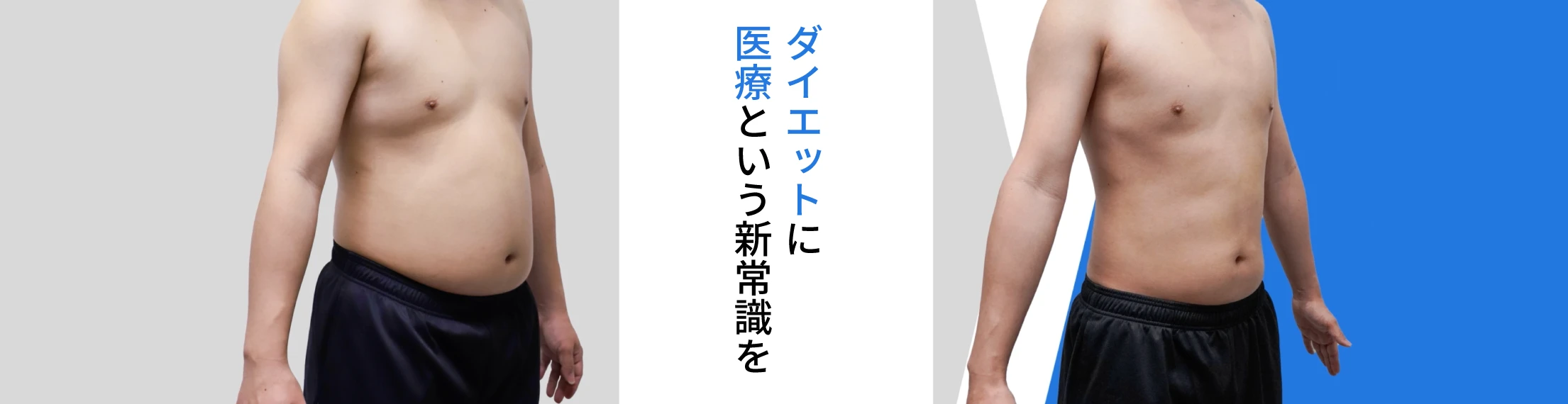メディカルダイエット