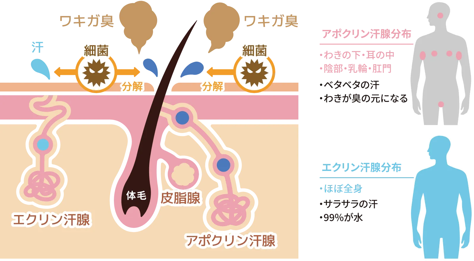 イラスト：わきがと多汗症の汗腺の違い