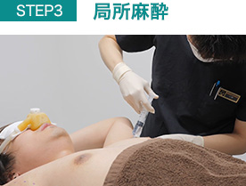 局所麻酔