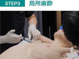 局所麻酔