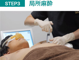 局所麻酔