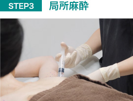 局所麻酔