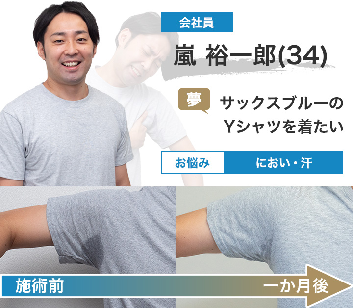 嵐さん