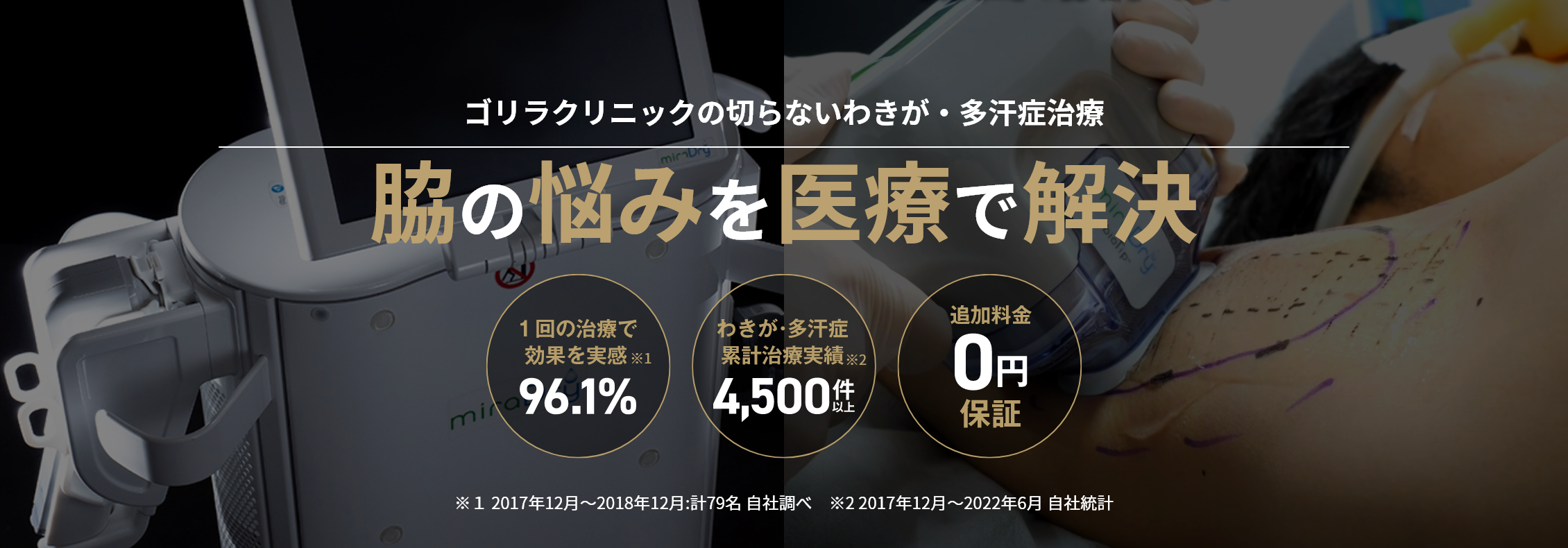 ゴリラクリニックの切らないわきが・多汗症治療 脇の悩みを医療で解決