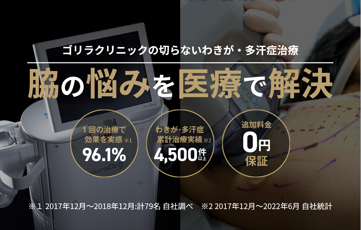 ゴリラクリニックの切らないわきが・多汗症治療 脇の悩みを医療で解決